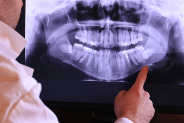 Best Chipped Tooth Repair Near Me  in Wagener, SC